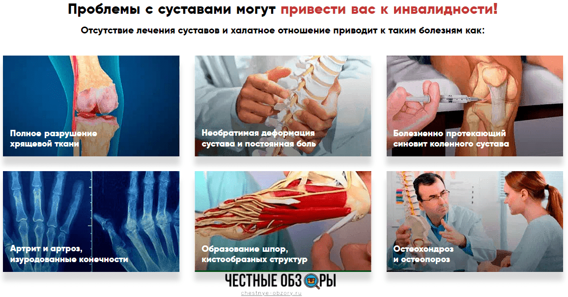 отсутствие лечение суставов приведет к инвалидности