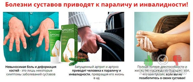 Боль в коленях