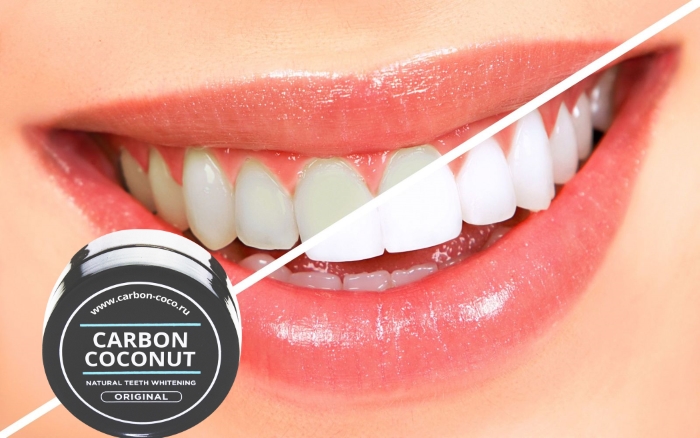 Как действует порошок Carbon Coconut (Карбон Коконат) для отбеливания зубов