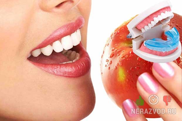Капа Dental Trainer для выравнивания зубов