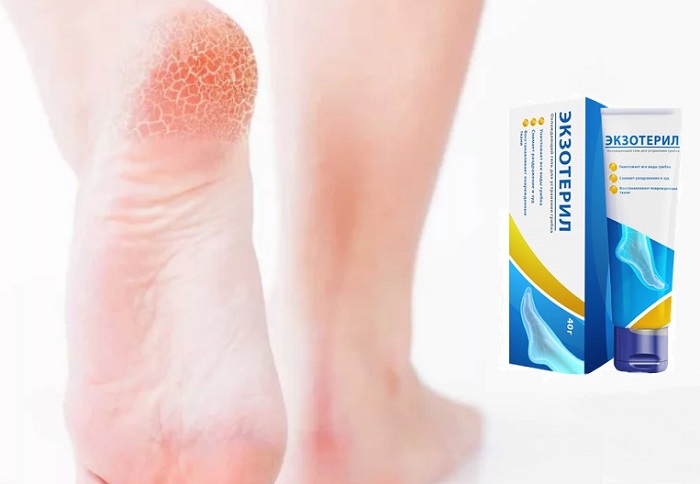 Экзотерил противогрибковый препарат от грибка стопы и ногтей: верните здоровье ногам!