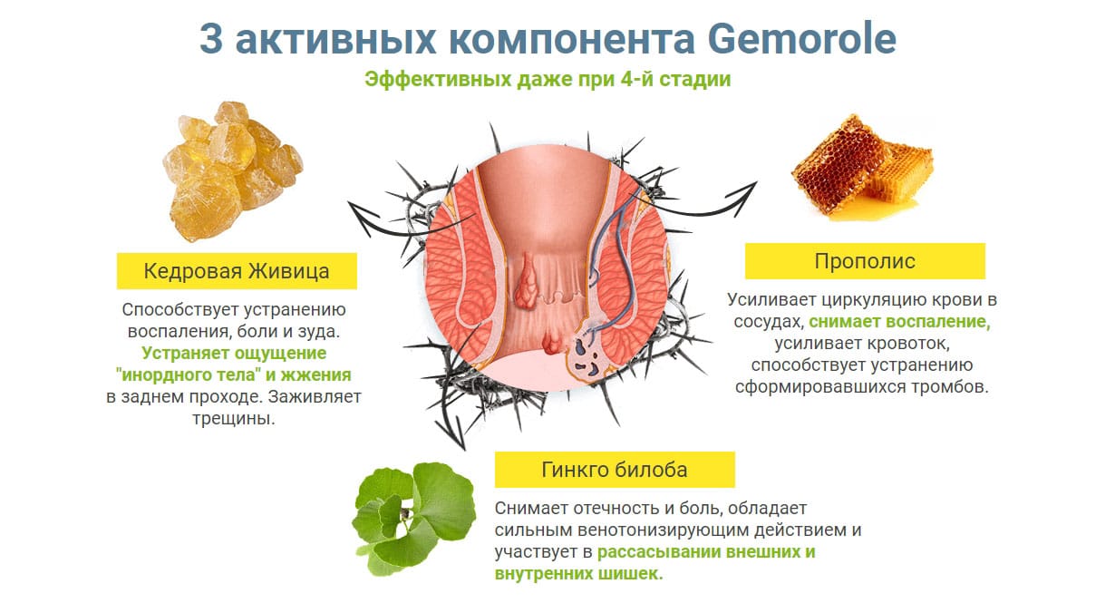 Народные методы при геморрое