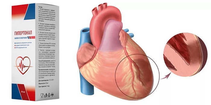 Гипертонал от гипертонии: за 1 курс восстановит естественный механизм регуляции артериального давления!
