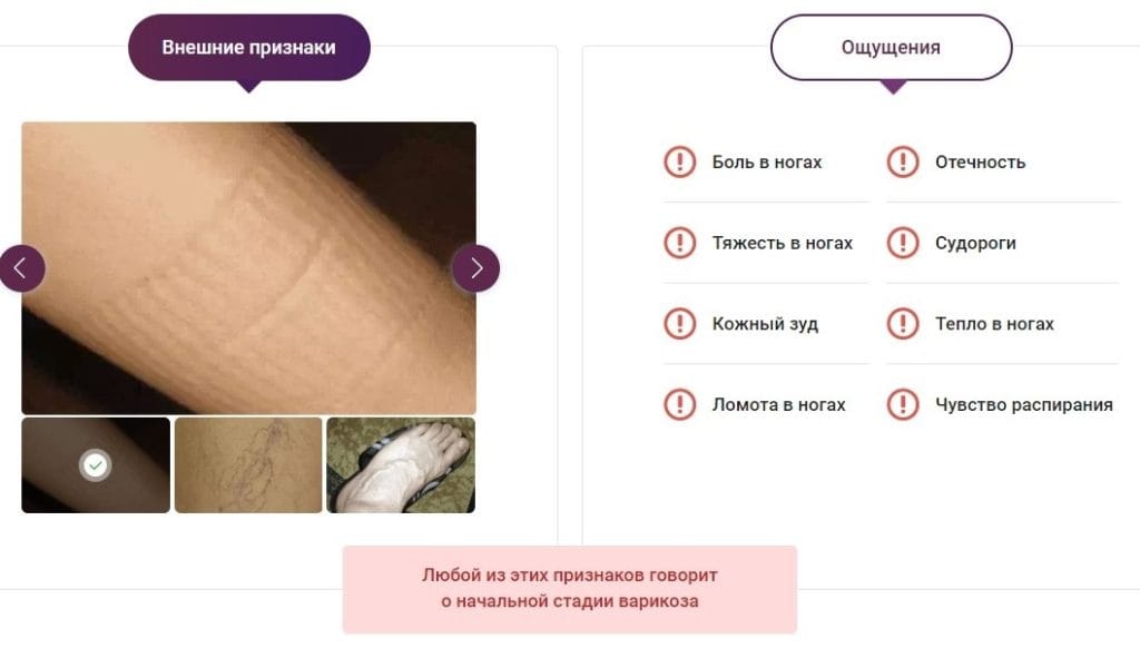 Делавен от вен - показания к применению мази от варикоза