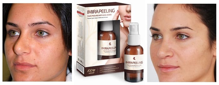 Imira peeling для лица, от морщин: бережное очищение и омоложение вашей кожи!