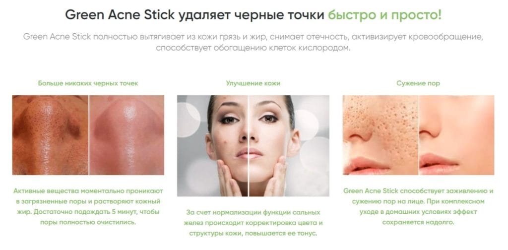 Green Acne Stick Π΄Π»Ρ ΠΎΡΠΈΡΡΠΊΠΈ ΠΏΠΎΡ - ΠΏΡΠΈΠ½ΡΠΈΠΏ Π΄Π΅ΠΉΡΡΠ²ΠΈΡ