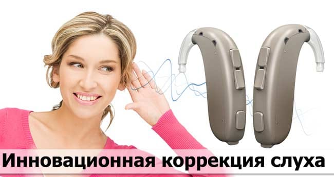 Oticon Xceed купить