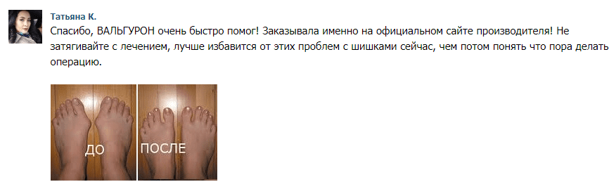 отзыв вальгурон
