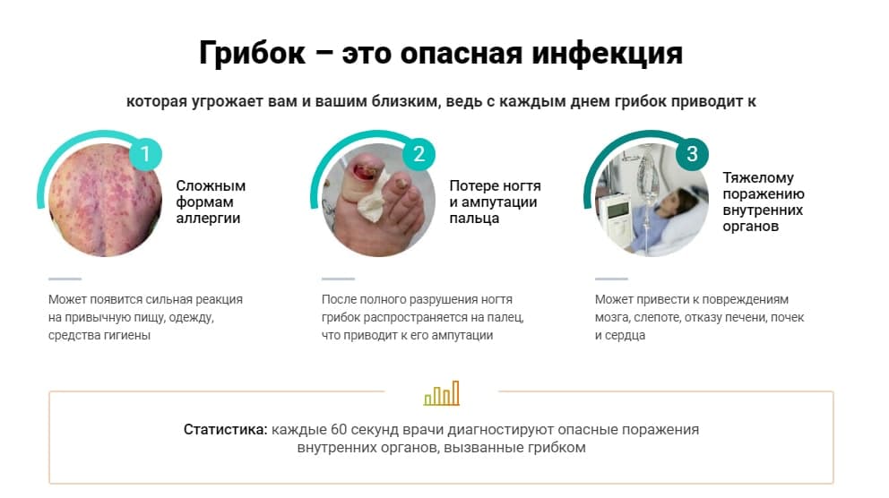 Ремитазол от грибка результат