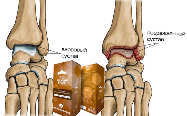 stamina бальзам отзывы