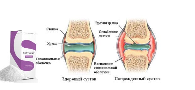 sustamax отзывы