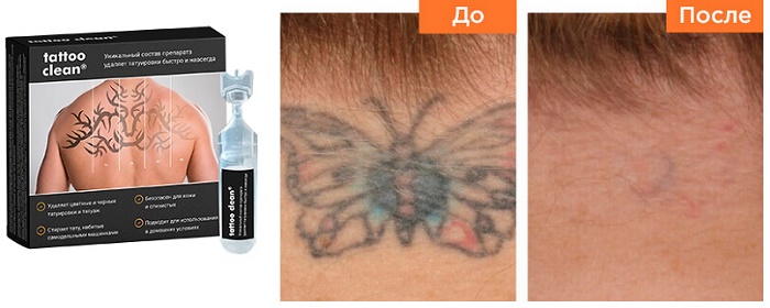 Tattoo clean для удаления татуировок: за 30 минут в домашних условиях, без боли и шрамов!