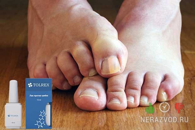 Лак TOLREX от грибка