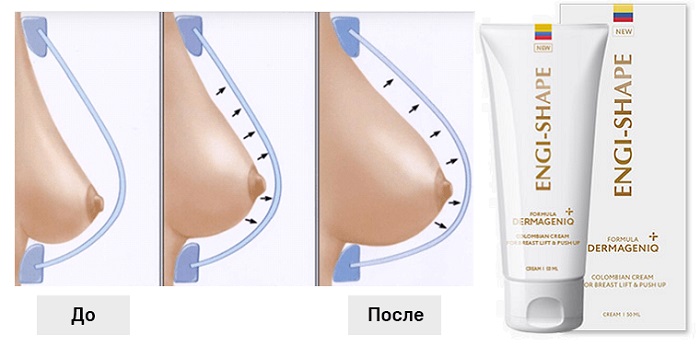 ENGI-SHAPE колумбийский крем: увеличивает и подтягивает женскую грудь без вреда для здоровья!